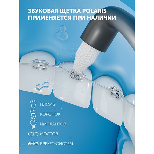 Электрлік тіс щеткасы Polaris PETB 0105 TC фото 7